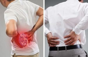 Bệnh thận yếu gây đau lưng, đau nhói, gây tê cứng dọc sống lưng