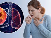 Top 10 dấu hiệu ung thư phổi biết sớm chữa sớm