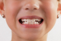 Những nguyên nhân khiến trẻ nghiến răng khi ngủ